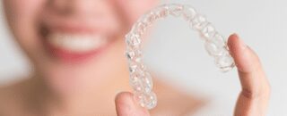 Invisalign Step-By-Step Procedure 