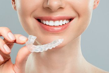 Invisalign Guide: Everything You Should Know