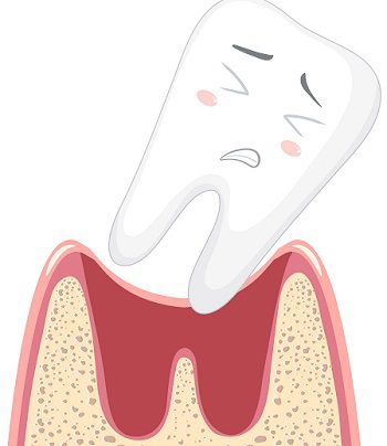 Benefits of Root Canal Therapy