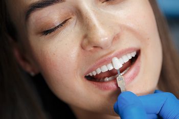 Benefits of Teeth Bleaching: Improving Your Smile and Confidence 