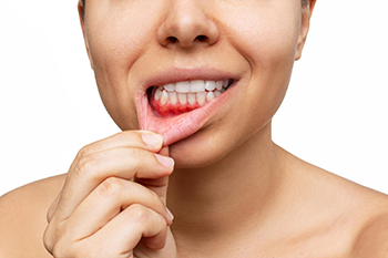 Toothaches and Swollen Gums: Effective Home Remedies 